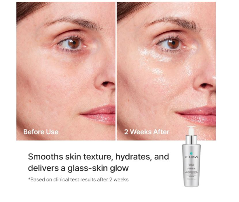 REJURAN® Turnover Ampoule 30ml